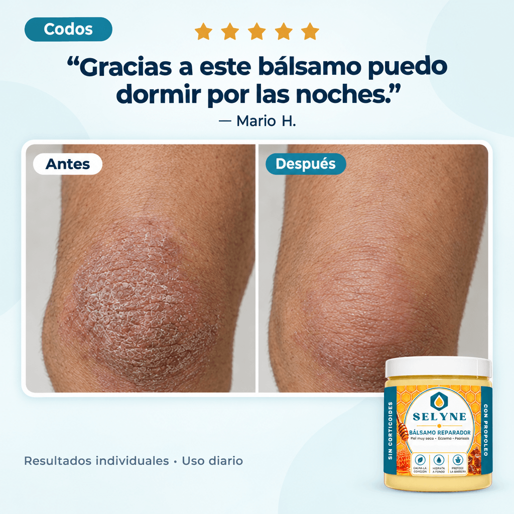 Bálsamo Reparador para piel muy seca y comezón®