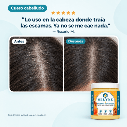Bálsamo Reparador para piel muy seca y comezón®