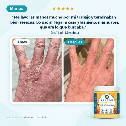 Bálsamo Reparador para piel muy seca y comezón®
