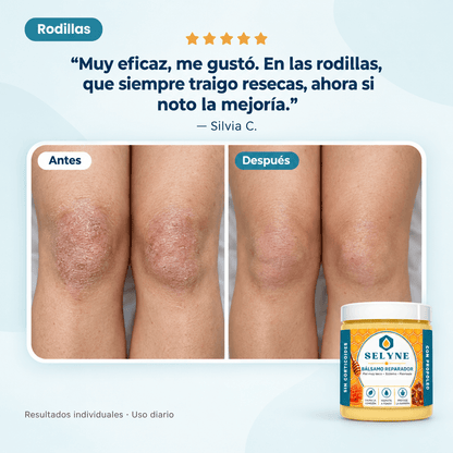 Bálsamo Reparador para piel muy seca y comezón®