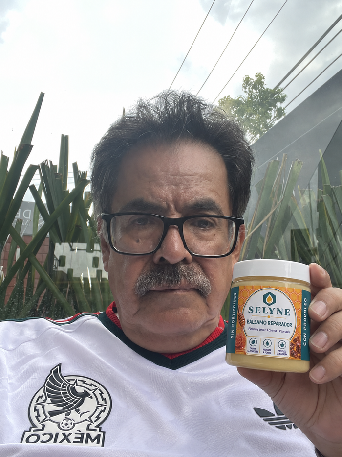 Cliente mostrando el bálsamo SELYNE