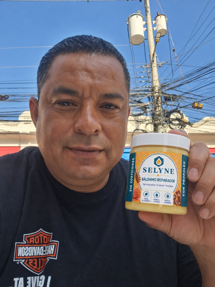 Cliente mostrando el bálsamo SELYNE
