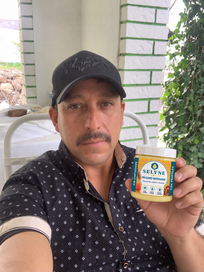 Cliente mostrando el bálsamo SELYNE
