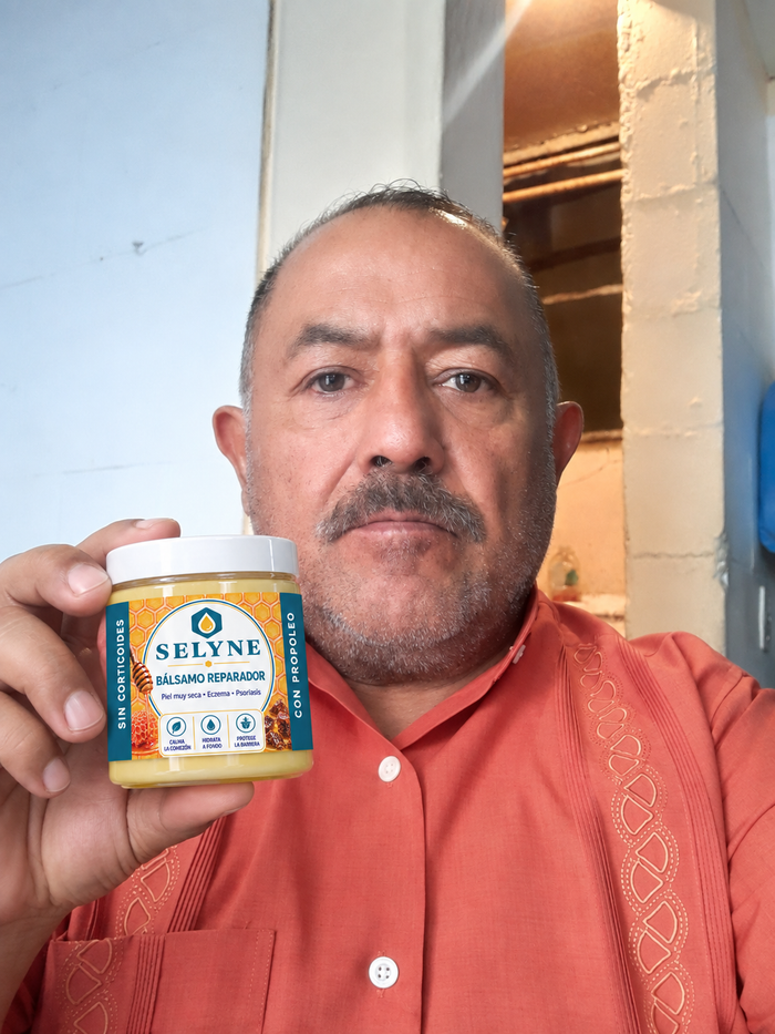 Cliente mostrando el bálsamo SELYNE